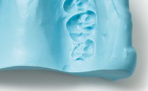 Alginato-Uso-Odontologia