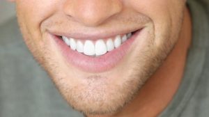 pastas de dientes blanqueantes