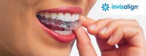InterORALIA - Promoción Ortodoncias con Brackets