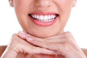 dentistas en Madrid blanqueamiento dental