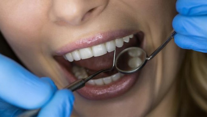 elegir dentista en Madrid