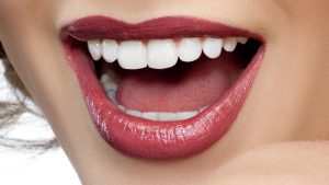 estetica dental carillas dentales