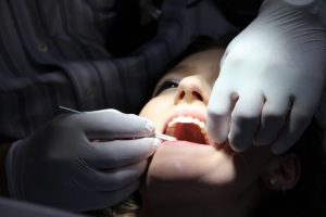 implantes dentales post extraccion