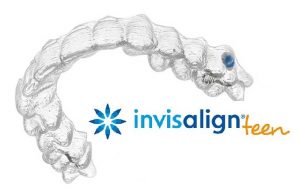Invisalign Teen Adolescentes