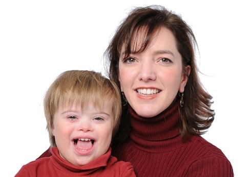 salud dental sindrome down