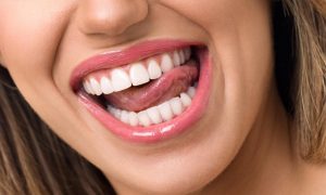 Tratamientos estética dental solicitados