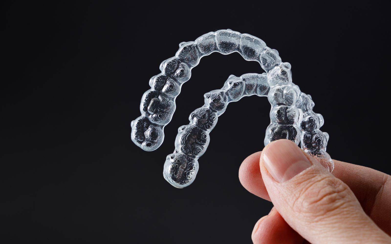 Retenedores dentales: qué son e importancia tras la ortodoncia