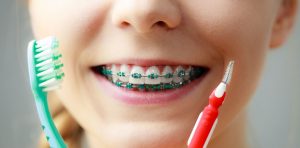 limpiar tus dientes brackets