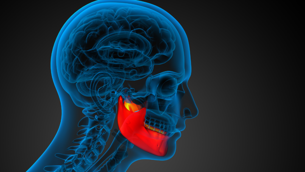 implante dental poco hueso